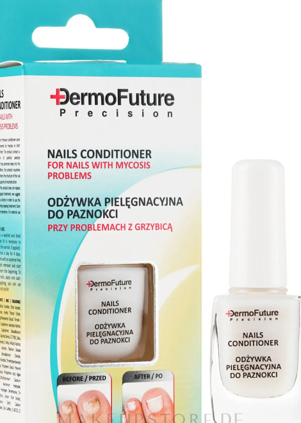 Antimykotische Nageltherapie