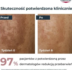 Doppelkammer-Gesichtsserum mit Zweifachwirkung gegen Pigmentflecken