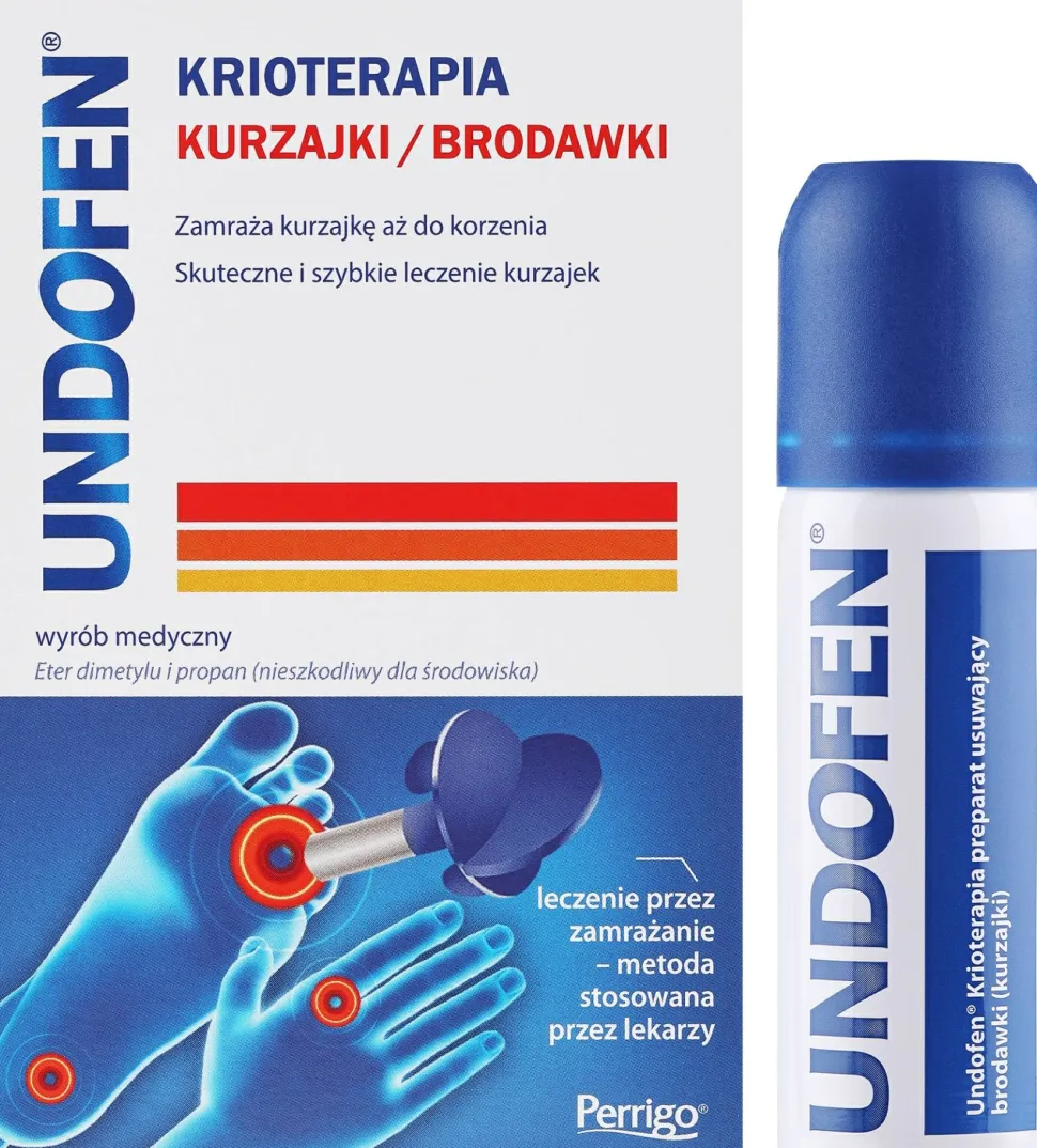 Kryotherapie gegen Warzen